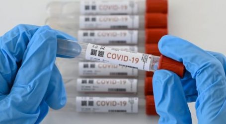 Pruebas serológicas, útiles para la detección de casos de COVID-19