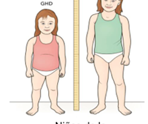 SUFREN DE TALLA BAJA ALREDEDOR DE 13 MILLONES DE PERSONAS EN MÉXICO