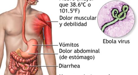 +Prevendrán con filtros sanitarios la entrada del ébola a territorio mexicano, por el Mundial de futbol; Transparencia de dicho, millones de pesos en observación